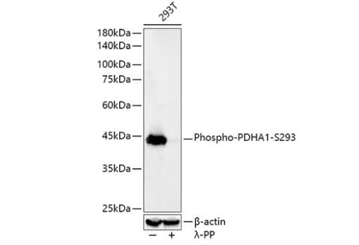 Western Blot: Pyruvate Dehydrogenase E1-alpha subunit [p Ser293] Antibody (9S3I4) [NBP3-16916] -analysis of lysates from HeLa cells, using Phospho-PDHA1-S293 Rabbit mAb at 1:23000 dilution.293T cells were treated by  lambda -PP mixed solution (1ul) at 30 c for 30 minutes.Secondary antibody: HRP Goat Anti-Rabbit IgG (H+L) at 1:10000 dilution.Lysates/proteins: 25uμg per lane.Blocking buffer: 3% nonfat dry milk in TBST.Detection: ECL Basic Kit.Exposure time: 30s.