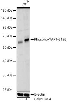 Western Blot: YAP1 [p Ser128] Antibody - Azide and BSA Free [YAP1] - Western blot analysis of lysates from HeLa cells using YAP1 Rabbit pAb  at 1:2000 dilution. HeLa cells were treated by Calyculin A (100 nM) at 37C for 30 minutes after serum-starvation overnight.Secondary antibody: HRP-conjugated Goat anti-Rabbit IgG (H+L)  at 1:10000 dilution.Lysates/proteins: 25 ug per lane.Blocking buffer: 3% nonfat dry milk in TBST.Detection: ECL Basic Kit .Exposure time: 30s.