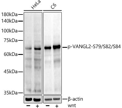 Western Blot: Vang-like Protein 2/VANGL2 [p Ser84, p Ser79, p Ser82] Antibody (6O6T6) [NBP3-16947] - Western blot analysis of various lysates using Vang-like Protein 2/VANGL2 Rabbit mAb at1:1000 dilution. HeLa and C6 cells were treated by wnt(100ng/ml) for 30 minutes.Secondary antibody: HRP-conjugated Goat anti-Rabbit IgG (H+L) at1:10000 dilution.Lysates/proteins: 25ug per lane.Blocking buffer: 3% nonfat dry milk in TBST.Detection: ECL Basic Kit.Exposure time: 90s.