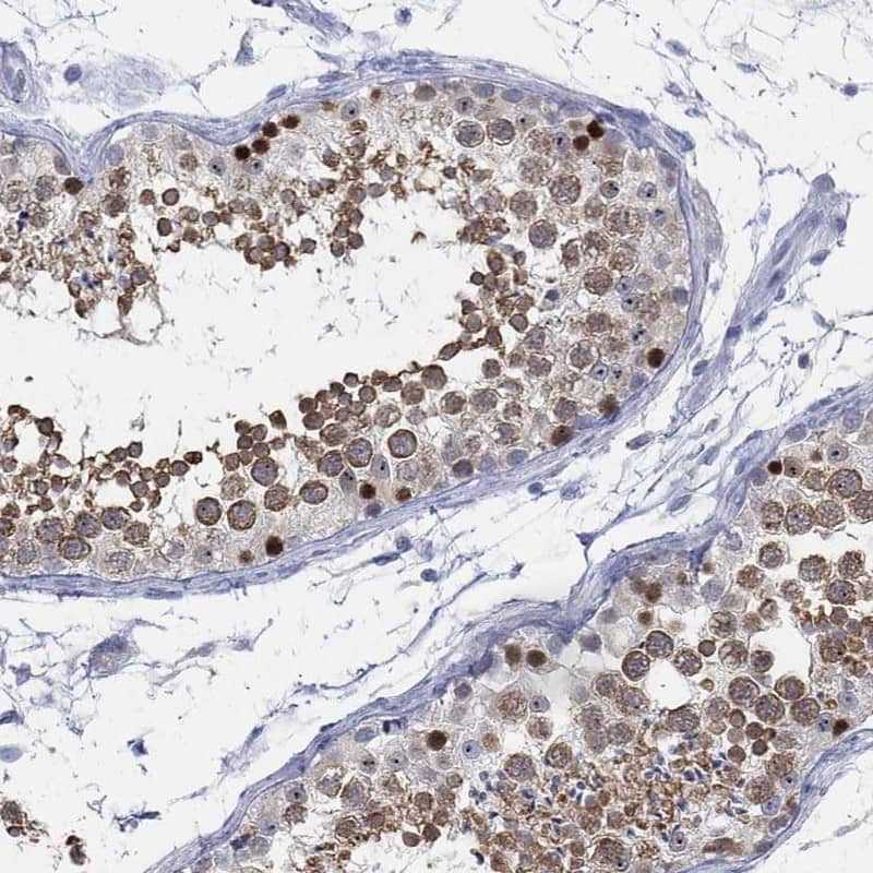 Staining of human testis shows high expression.