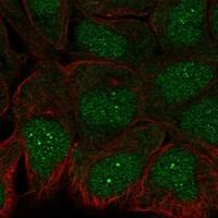 Staining of human cell line RT4 shows localization to nucleoplasm, nucleoli fibrillar center & cytosol.
