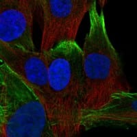 Staining of human cell line BJ shows localization to plasma membrane & actin filaments.