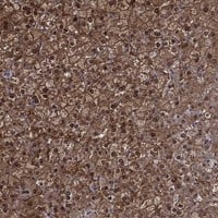 Staining of human liver shows strong cytoplasmic and nuclear positivity in hepatocytes.