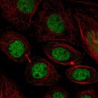 Staining of human cell line SiHa shows localization to nucleoplasm.
