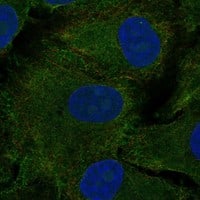 Staining of human cell line A549 shows localization to plasma membrane.