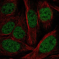 Immunocytochemistry/ Immunofluorescence PHF21A Antibody - BSA Free