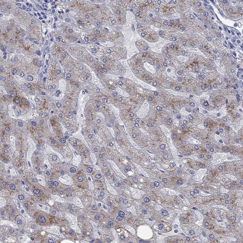 Staining of human liver shows moderate cytoplasmic positivity in hepatocytes.