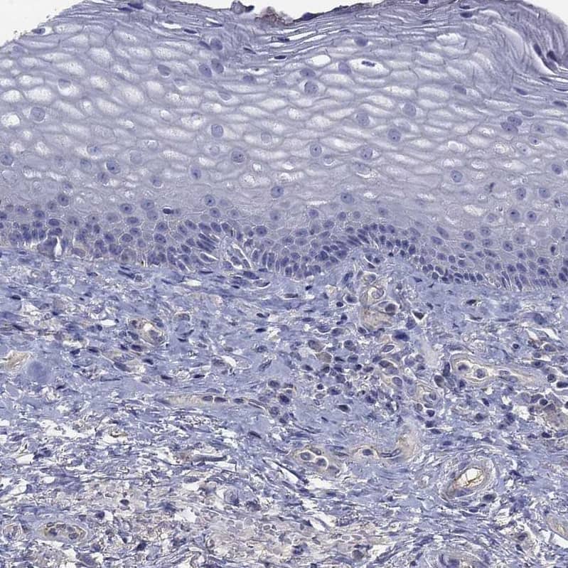 Staining of human skin shows no positivity in squamous epithelial cells as expected.