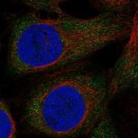 Staining of human cell line U-2 OS shows localization to cytosol.