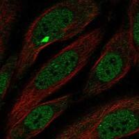 Staining of human cell line SiHa shows localization to nucleoplasm & nuclear bodies.