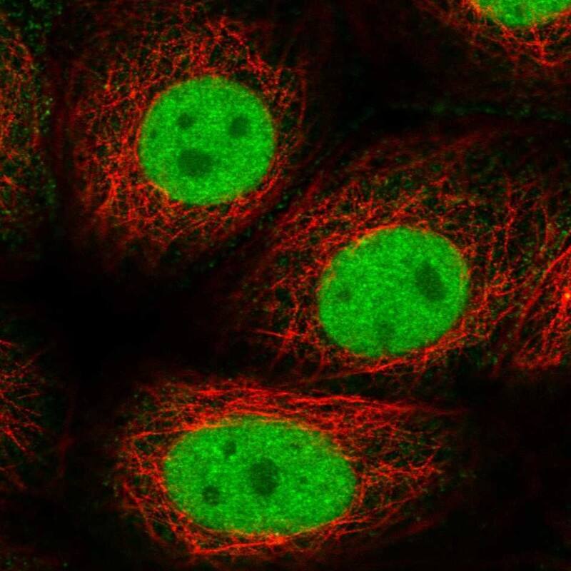 Staining of human cell line MCF7 shows localization to nucleoplasm & cell junctions.