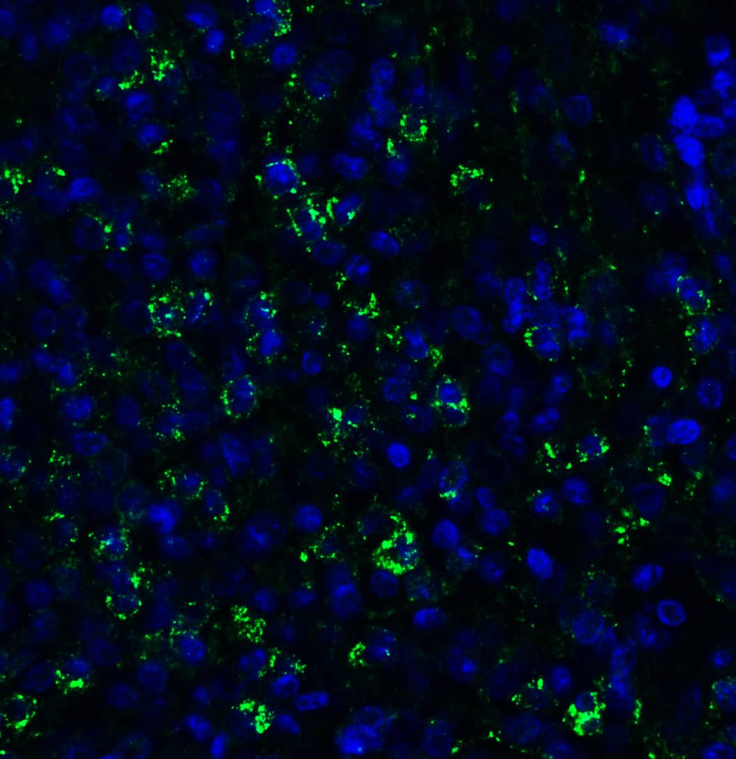 Immunohistochemistry: PEX10 Antibody - BSA Free [NBP3-18137] - Figure 5 Immunofluorescence Validation of PEX10 in Human Spleen Immunofluorescent analysis of 4% paraformaldehyde-fixed human spleen labeling PEX10 with  at 20 u/mL, followed by goat anti-rabbit IgG secondary antibody at 1/500 dilution (green) and DAPI staining (blue).