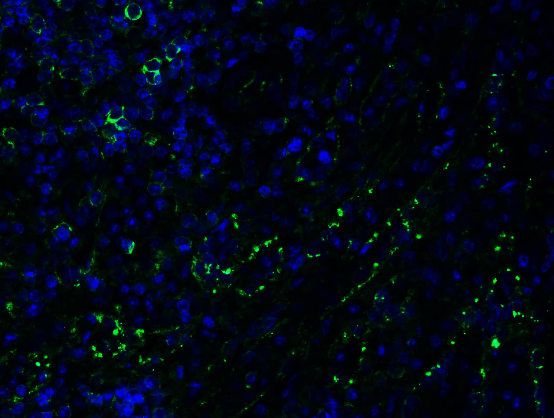 Immunohistochemistry: PEX3 Antibody - BSA Free [NBP3-18138] - Figure 5 Immunofluorescence Validation of PEX3 in Human SpleenImmunofluorescent analysis of 4% paraformaldehyde-fixed human spleen labeling PEX3 with  at 20 u/mL, followed by goat anti-rabbit IgG secondary antibody at 1/500 dilution (green) and DAPI staining (blue).