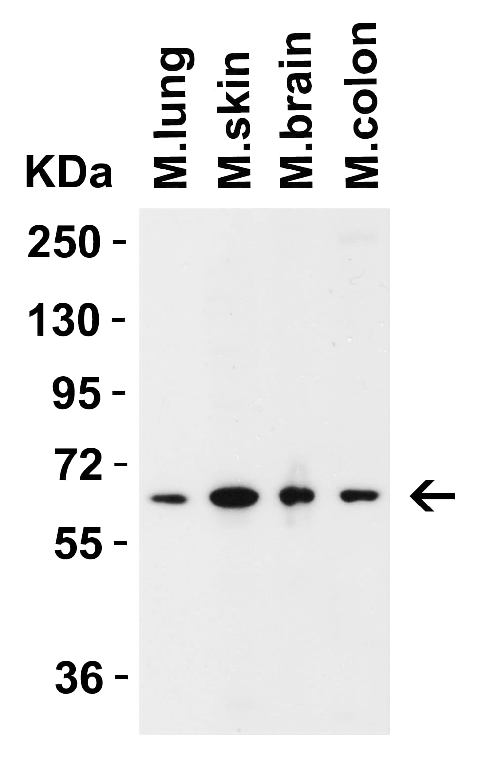 Western Blot: MCPIP1/ZC3H12A Antibody - BSA Free [NBP3-18333] - Validation in Mouse Tissues.Loading: 15 ug  of lysates per lane.  Antibodies: ZC3H12A , 2 ug/mL, 1h incubation at RT in 5% NFDM/TBST.  Secondary: Goat anti-rabbit IgG HRP conjugate at 1:10,000 dilution.