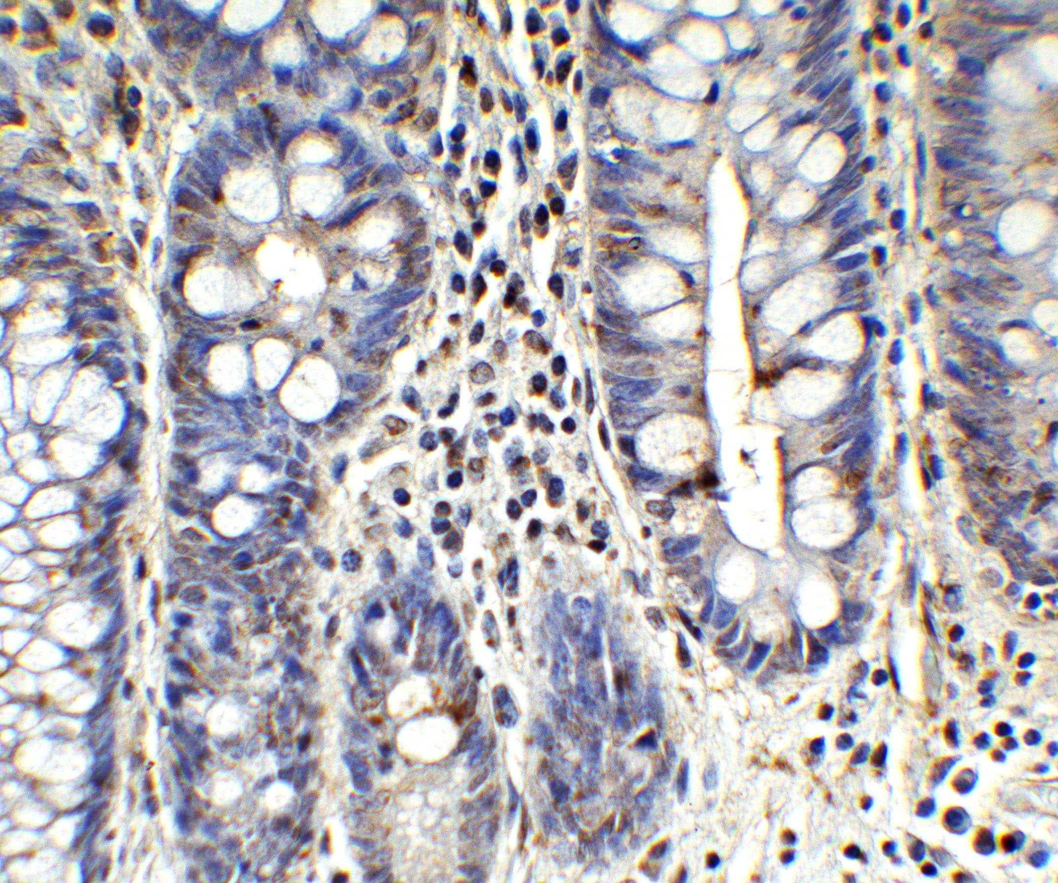 Immunohistochemistry: MCPIP1/ZC3H12A Antibody - BSA Free [NBP3-18333] - Validation of ZC3H12A in Human Testis. Immunohistochemical analysis of paraffin-embedded human testis tissue using anti-ZC3H12A antibody  at 1 ug/mL. Tissue was fixed with formaldehyde and blocked with 10% serum for 1 h at RT; antigen retrieval was by heat mediation with a citrate buffer (pH6). Samples were incubated with primary antibody overnight at 4C. A goat anti-rabbit IgG H&L (HRP) at 1/250 was used as secondary. Counter stained with Hematoxylin.