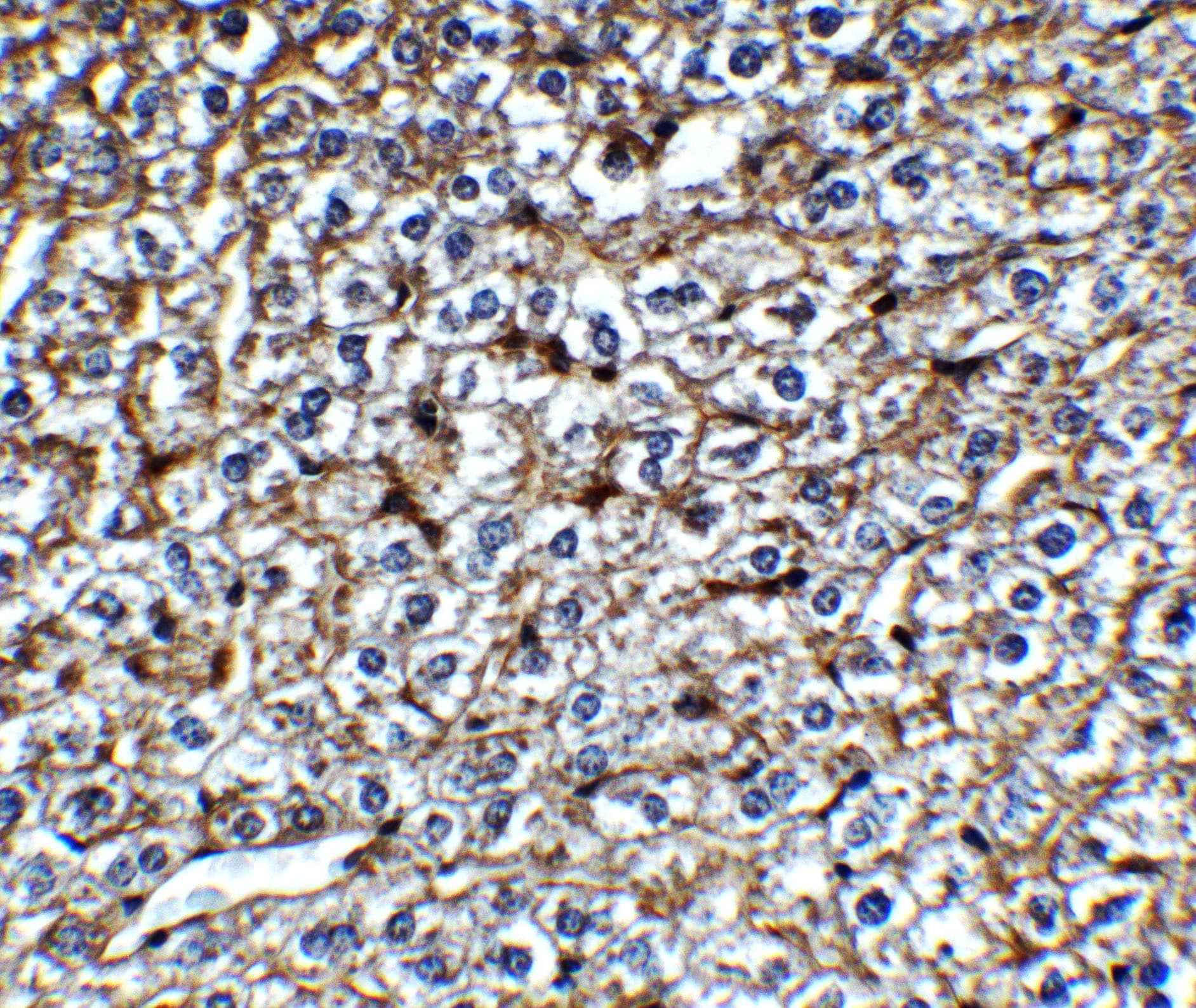 Immunohistochemistry: MCPIP1/ZC3H12A Antibody - BSA Free [NBP3-18333] -  Validation of ZC3H12A in Mouse Liver.Immunohistochemical analysis of paraffin-embedded mouse liver tissue using anti-ZC3H12A antibody  at 1 ug/mL. Tissue was fixed with formaldehyde and blocked with 10% serum for 1 h at RT; antigen retrieval was by heat mediation with a citrate buffer (pH6). Samples were incubated with primary antibody overnight at 4C. A goat anti-rabbit IgG H&L (HRP) at 1/250 was used as secondary. Counter stained with Hematoxylin