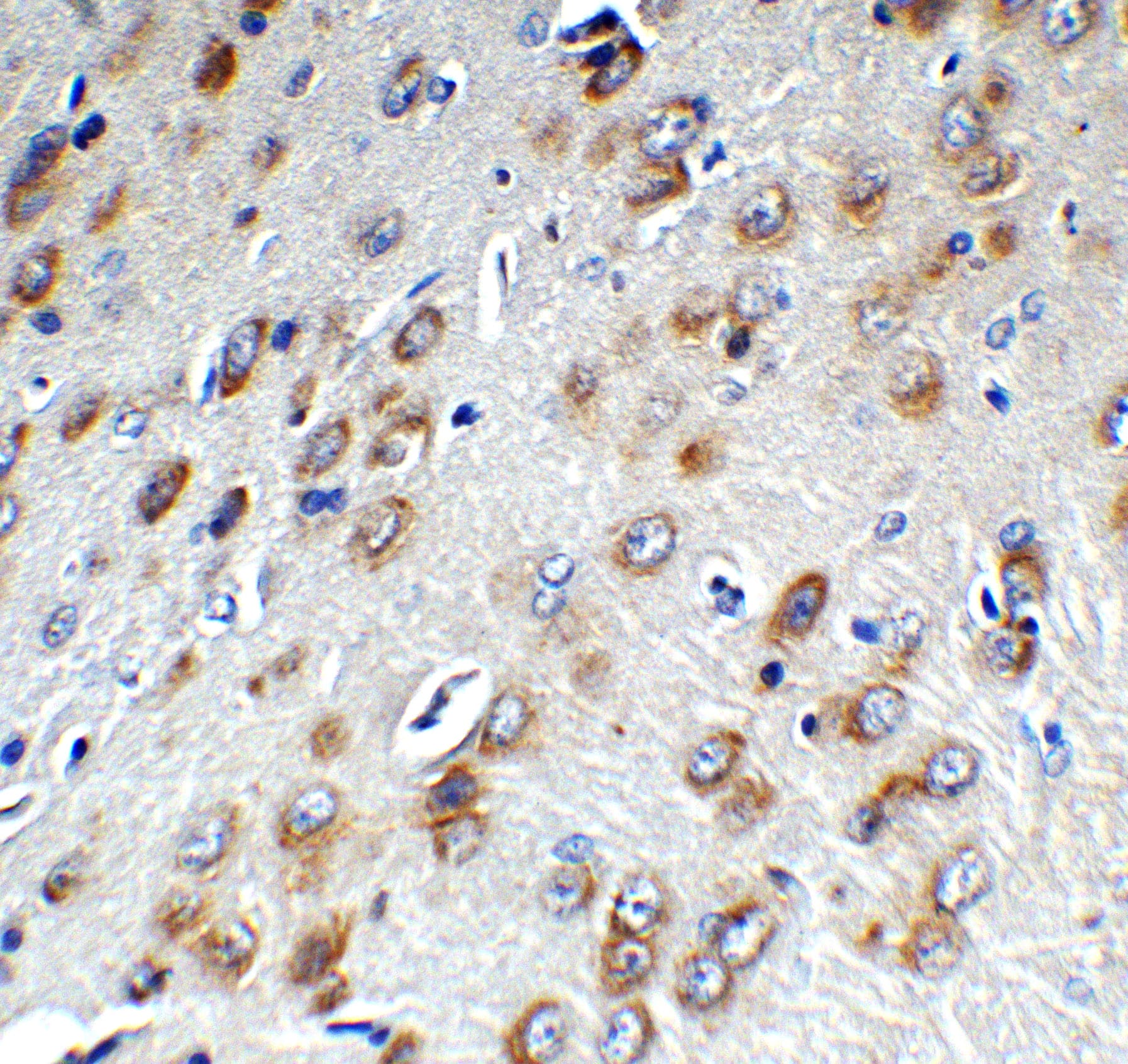 Immunohistochemistry: MCPIP1/ZC3H12A Antibody - BSA Free [NBP3-18333] - Validation of ZC3H12A in Rat Brain. Immunohistochemical analysis of paraffin-embedded rat brain tissue using anti-ZC3H12A antibody  at 1 ug/mL. Tissue was fixed with formaldehyde and blocked with 10% serum for 1 h at RT; antigen retrieval was by heat mediation with a citrate buffer (pH6). Samples were incubated with primary antibody overnight at 4C. A goat anti-rabbit IgG H&L (HRP) at 1/250 was used as secondary. Counter stained with Hematoxylin.