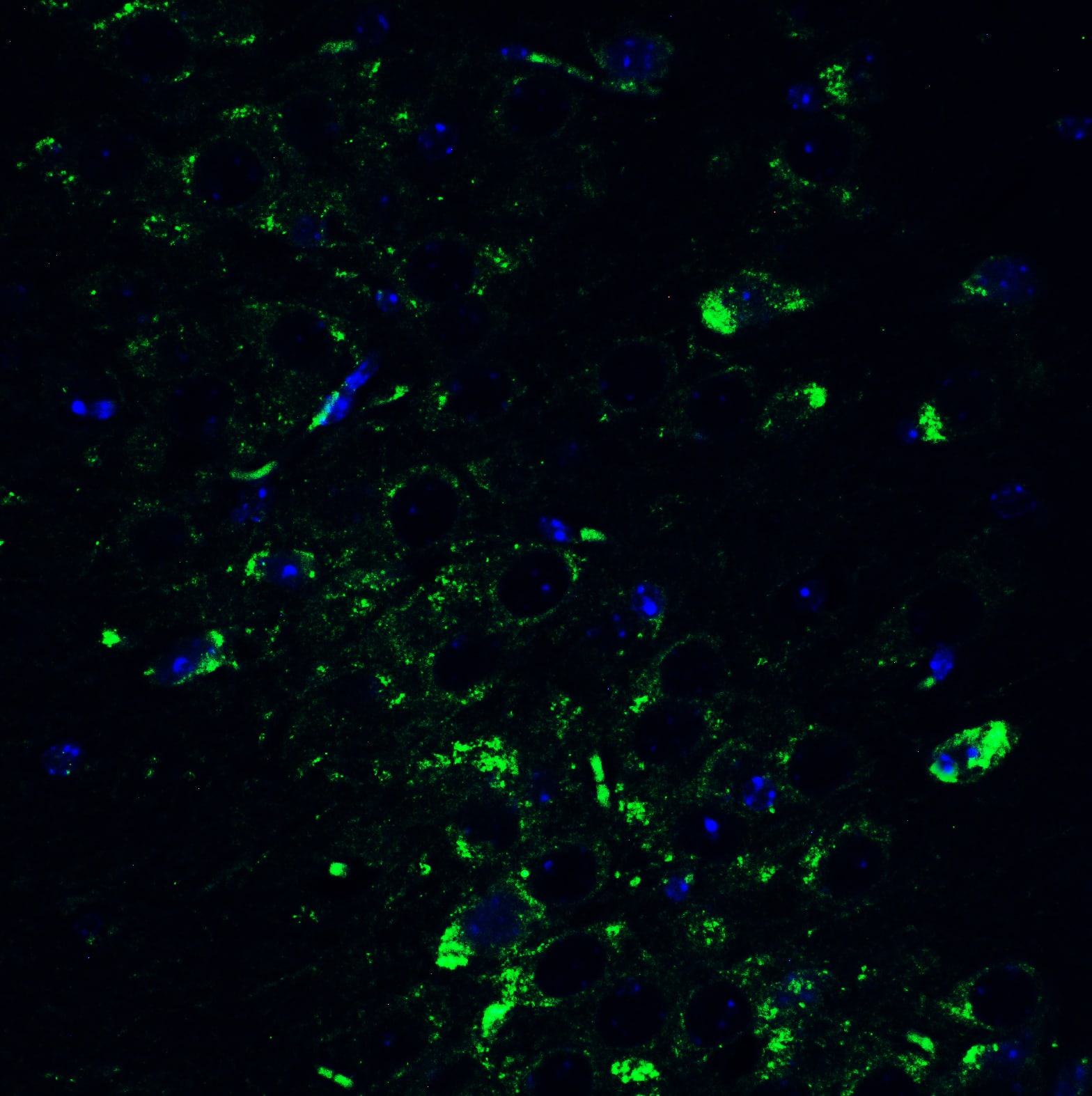 Immunocytochemistry/ Immunofluorescence: mtRNA polymerase Antibody - BSA Free [NBP3-18334] - Validation of POLRMT in Mouse Brain. Immunofluorescent analysis of 4% paraformaldehyde-fixed mouse brain labeling POLRMT with  at 10 ug/mL, followed by goat anti-rabbit IgG secondary antibody at 1/500 dilution (green) and DAPI staining (blue).