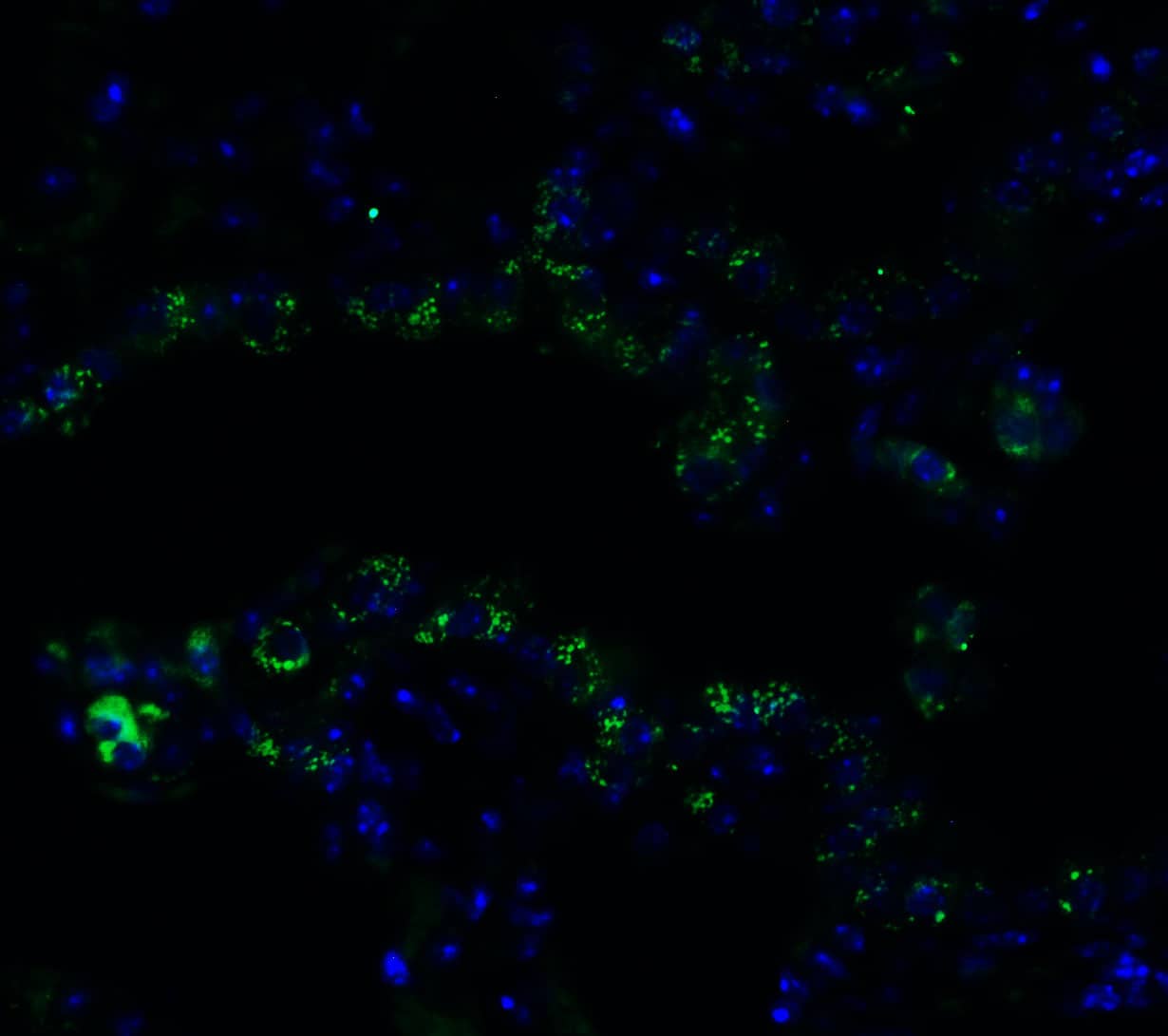 Immunocytochemistry/ Immunofluorescence: Frizzled-6 Antibody - BSA Free [NBP3-18335] - Validation of FZD6 in Mouse Lung.Immunofluorescent analysis of 4% paraformaldehyde-fixed mouse lung labeling FZD6 with  at 10 ug/mL, followed by goat anti-rabbit IgG secondary antibody at 1/500 dilution (green) and DAPI staining (blue).