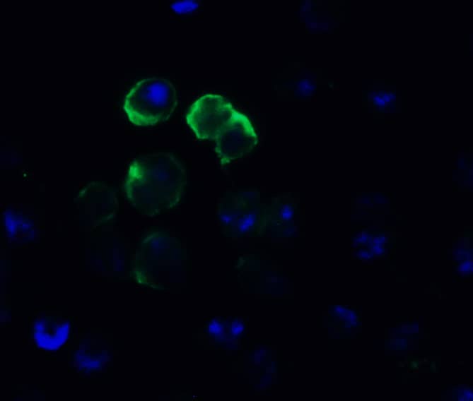 Immunocytochemistry/ Immunofluorescence: Frizzled-6 Antibody - BSA Free [NBP3-18335] - Validation of FZD6 in Daudi Cells. Immunofluorescent analysis of 4% paraformaldehyde-fixed Daudi cells labeling FZD6 with  at 10 ug/mL, followed by goat anti-rabbit IgG secondary antibody at 1/500 dilution (green) and DAPI staining (blue).