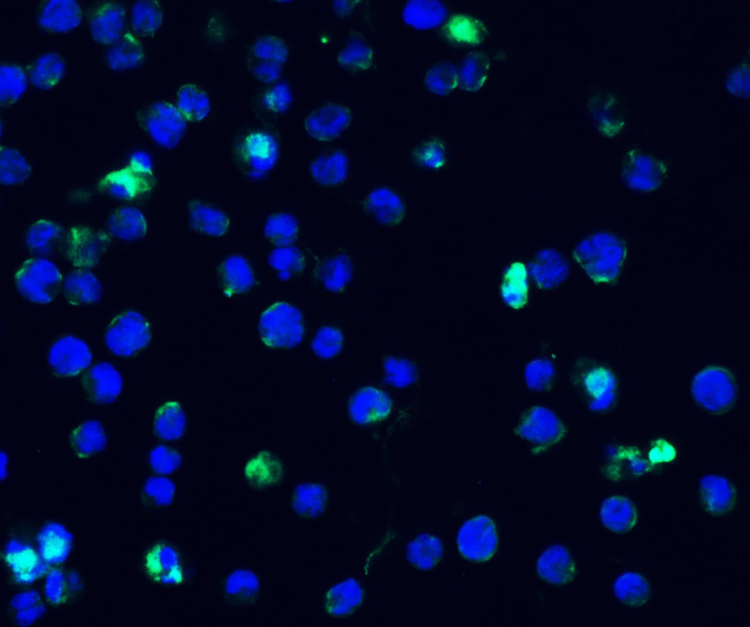 Immunocytochemistry/ Immunofluorescence: IFI16 Antibody - BSA Free [NBP3-18336] - Validation of IFI16 in Human Molt4 Cells. Immunofluorescent analysis of 4% paraformaldehyde-fixed Molt4 cells labeling IFI16 with  at 20 ug/mL, followed by goat anti-rabbit IgG secondary antibody at 1/500 dilution (green) and DAPI staining (blue).
