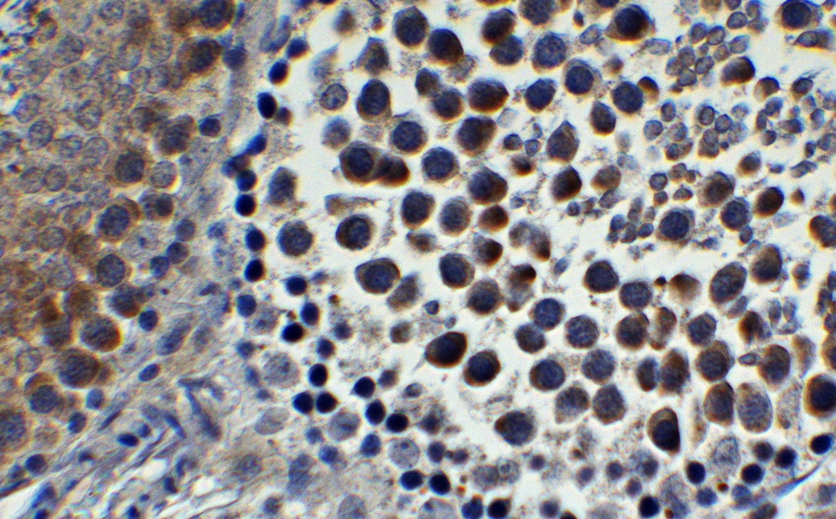 Immunohistochemistry: IFI16 Antibody - BSA Free [NBP3-18336] - Validation of IFI16 in Rat Testis. Immunohistochemical analysis of paraffin-embedded rat testis tissue using anti-IFI16 antibody  at 1 ug/mL. Tissue was fixed with formaldehyde and blocked with 10% serum for 1 h at RT; antigen retrieval was by heat mediation with a citrate buffer (pH6). Samples were incubated with primary antibody overnight at 4C. A goat anti-rabbit IgG H&L (HRP) at 1/250 was used as secondary. Counter stained with Hematoxylin.