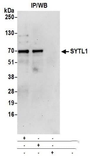 Immunoprecipitation:[NBP3-18369]-Detection of human SYTL1 by western blot of immunoprecipitates. Samples: Whole cell lysate from Jurkat cells prepared using NETN lysis buffer. Antibodies: Affinity purified rabbit anti-SYTL1 antibody used for IP at 6 µg per reaction. SYTL1 was also immunoprecipitated by rabbit anti-SYTL1 antibody. For blotting immunoprecipitated SYTL1, was used at 0. 4 mg/ml. Detection: Chemiluminescence with an exposure time of 30 seconds.