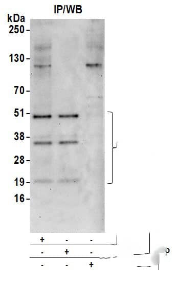 Immunoprecipitation:[NBP3-18370]-Detection of human CFDP1 by western blot of immunoprecipitates. Samples: Whole cell lysate from HeLa cells prepared using NETN lysis buffer. Antibodies: Affinity purified rabbit anti-CFDP1 antibody used for IP at 6 µg per reaction. CFDP1 was also immunoprecipitated by rabbit anti-CFDP1 antibody. For blotting immunoprecipitated CFDP1, was used at 0. 4 mg/ml. Detection: Chemiluminescence with an exposure time of 30 seconds.