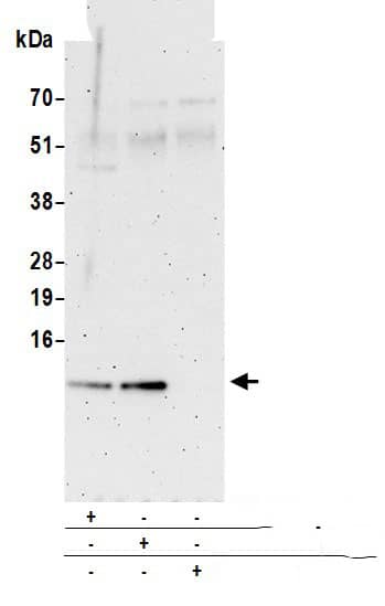 Immunoprecipitation:[NBP3-18371]-Detection of human S100A16 by western blot of immunoprecipitates. Samples: Whole cell lysate from HeLa cells prepared using NETN lysis buffer. Antibodies: Affinity purified rabbit anti-S100A16 antibody used for IP at 6 µg per reaction. S100A16 was also immunoprecipitated by rabbit anti-S100A16 antibody. For blotting immunoprecipitated S100A16, was used at 0. 4 mg/ml. Detection: Chemiluminescence with an exposure time of 3 minutes.