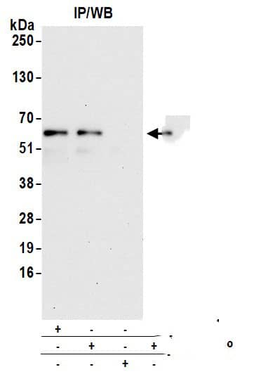 Immunoprecipitation:[NBP3-18374]-Detection of human CLCC1 by western blot of immunoprecipitates. Samples: Whole cell lysate from 293T cells prepared using NETN lysis buffer. Antibodies: Affinity purified rabbit anti-CLCC1 antibody used for IP at 6 µg per reaction. CLCC1 was also immunoprecipitated by rabbit anti-CLCC1 antibody. For blotting immunoprecipitated CLCC1, was used at 0. 4 mg/ml. Detection: Chemiluminescence with an exposure time of 30 seconds.