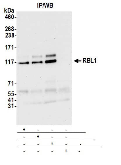 Immunoprecipitation:[NBP3-18375]-Detection of human RBL1 by western blot of immunoprecipitates. Samples: Whole cell lysate from Hep-G2 cells prepared using NETN lysis buffer. Antibodies: Affinity purified rabbit anti-RBL1 antibody used for IP at 6 µg per reaction. RBL1 was also immunoprecipitated by a previous lot of this antibody and a second antibody against a different epitope of RBL1. For blotting immunoprecipitated RBL1, was used at 0. 4 mg/ml. Detection: Chemiluminescence with an exposure time of 10 seconds.