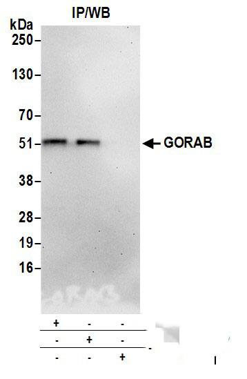 Immunoprecipitation:[NBP3-18379]-Detection of human GORAB by western blot of immunoprecipitates. Samples: Whole cell lysate from HeLa cells prepared using NETN lysis buffer. Antibodies: Affinity purified rabbit anti-GORAB antibody used for IP at 6 µg per reaction. GORAB was also immunoprecipitated by rabbit anti-GORAB antibody. For blotting immunoprecipitated GORAB, was used at 0. 4 mg/ml. Detection: Chemiluminescence with an exposure time of 3 minutes.