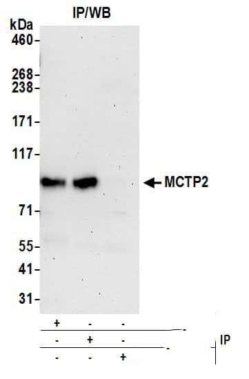 Immunoprecipitation:[NBP3-18380]-Detection of human MCTP2 by western blot of immunoprecipitates. Samples: Whole cell lysate from HeLa cells prepared using NETN lysis buffer. Antibodies: Affinity purified rabbit anti-MCTP2 antibody used for IP at 6 µg per reaction. MCTP2 was also immunoprecipitated by rabbit anti-MCTP2 antibody. For blotting immunoprecipitated MCTP2, was used at 0. 4 mg/ml. Detection: Chemiluminescence with an exposure time of 75 seconds.