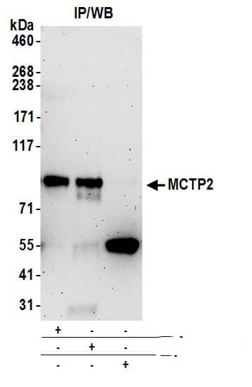 Immunoprecipitation:[NBP3-18381]-Detection of human MCTP2 by western blot of immunoprecipitates. Samples: Whole cell lysate from HeLa cells prepared using NETN lysis buffer. Antibodies: Affinity purified rabbit anti-MCTP2 antibody used for IP at 6 µg per reaction. MCTP2 was also immunoprecipitated by rabbit anti-MCTP2 antibody. For blotting immunoprecipitated MCTP2, was used at 0. 4 mg/ml. Detection: Chemiluminescence with an exposure time of 3 minutes.