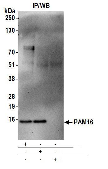 Immunoprecipitation:[NBP3-18382]-Detection of human PAM16 by western blot of immunoprecipitates. Samples: Whole cell lysate from 293T cells prepared using NETN lysis buffer. Antibodies: Affinity purified rabbit anti-PAM16 antibody used for IP at 6 µg per reaction. PAM16 was also immunoprecipitated by rabbit anti-PAM16 antibody. For blotting immunoprecipitated PAM16, was used at 0. 4 mg/ml. Detection: Chemiluminescence with an exposure time of 30 seconds.