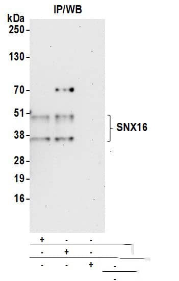 Immunoprecipitation:[NBP3-18385]-Detection of human SNX16 by western blot of immunoprecipitates. Samples: Whole cell lysate from Jurkat cells prepared using NETN lysis buffer. Antibodies: Affinity purified rabbit anti-SNX16 antibody used for IP at 6 µg per reaction. SNX16 was also immunoprecipitated by rabbit anti-SNX16 antibody. For blotting immunoprecipitated SNX16, was used at 0. 4 mg/ml. Detection: Chemiluminescence with an exposure time of 30 seconds.