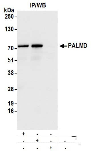 Immunoprecipitation:[NBP3-18389]-Detection of human PALMD by western blot of immunoprecipitates. Samples: Whole cell lysate from HeLa cells prepared using NETN lysis buffer. Antibodies: Affinity purified rabbit anti-PALMD antibody used for IP at 6 µg per reaction. PALMD was also immunoprecipitated by rabbit anti-PALMD antibody For blotting immunoprecipitated PALMD, A was used at 0. 4 mg/ml. Detection: Chemiluminescence with an exposure time of 1 second.