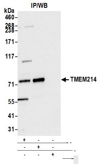 Immunoprecipitation:[NBP3-18390]-Detection of human TMEM214 by western blot of immunoprecipitates. Samples: Whole cell lysate from Hep-G2 cells prepared using NETN lysis buffer. Antibodies: Affinity purified rabbit anti-TMEM214 antibody used for IP at 6 µg per reaction. TMEM214 was also immunoprecipitated by rabbit anti-TMEM214 antibody. For blotting immunoprecipitated TMEM214, was used at 0. 4 mg/ml. Detection: Chemiluminescence with an exposure time of 1 second.