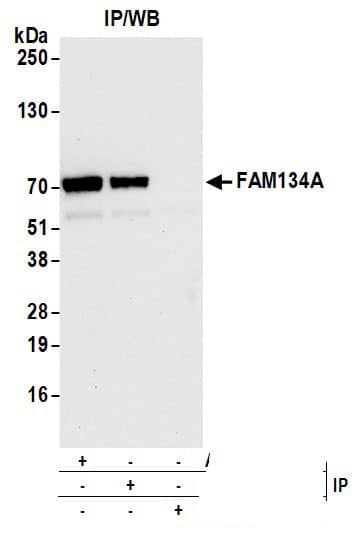 Immunoprecipitation:[NBP3-18391]-Detection of human FAM134A by western blot of immunoprecipitates. Samples: Whole cell lysate from K-562 cells prepared using NETN lysis buffer. Antibodies: Affinity purified rabbit antibody lot 2 used for IP at 6 µg per reaction. FAM134A was also immunoprecipitated by a previous lot of this antibody. For blotting immunoprecipitated , was used at 0. 4 mg/ml. Detection: Chemiluminescence with an exposure time of 10 seconds.