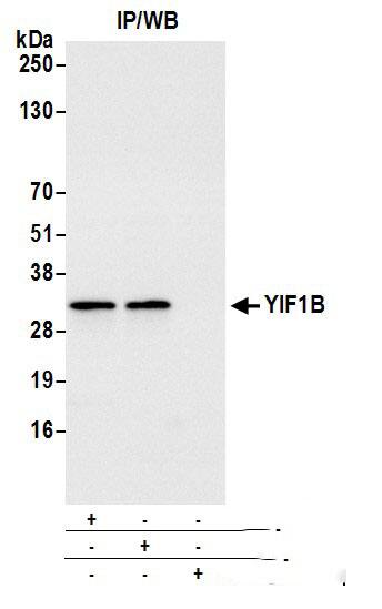 Immunoprecipitation:[NBP3-18392]-Detection of human YIF1B by western blot of immunoprecipitates. Samples: Whole cell lysate from K-562 cells prepared using NETN lysis buffer. Antibodies: Affinity purified rabbit anti-YIF1B antibody used for IP at 6 µg per reaction. YIF1B was also immunoprecipitated by rabbit anti-YIF1B antibody. For blotting immunoprecipitated YIF1B, was used at 0. 4 mg/ml. Detection: Chemiluminescence with an exposure time of 3 seconds.