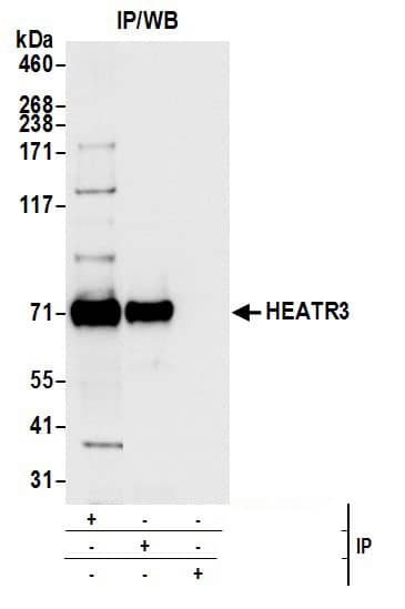Immunoprecipitation:[NBP3-18393]-Detection of human HEATR3 by western blot of immunoprecipitates. Samples: Whole cell lysate from HEK293T cells prepared using NETN lysis buffer. Antibodies: Affinity purified rabbit anti-HEATR3 antibody used for IP at 6 µg per reaction. HEATR3 was also immunoprecipitated by rabbit anti-HEATR3 antibody. For blotting immunoprecipitated HEATR3, was used at 0. 4 mg/ml. Detection: Chemiluminescence with an exposure time of 1 second.