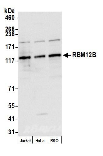 Western Blot;YTHD1 Antibody  Whole cell lysate (10 µg) from Jurkat, HeLa, and RKO cells prepared using NETN lysis buffer. Antibody: Affinity purified rabbit anti-RBM12B antibody  used for WB at 0.04 mg/ml. Detection: Chemiluminescence with an exposure time of 1 second.