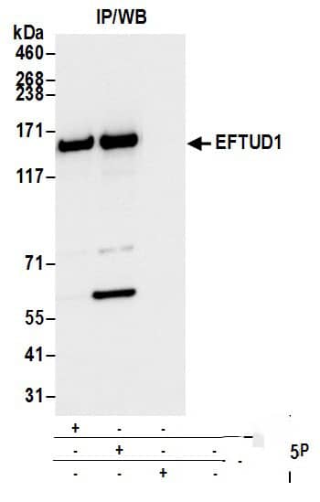 Immunoprecipitation:[NBP3-18400]-Detection of human EFTUD1 by western blot of immunoprecipitates. Samples: Whole cell lysate from RKO cells prepared using NETN lysis buffer. Antibodies: Affinity purified rabbit anti-EFTUD1 antibody used for IP at 6 µg per reaction. EFTUD1 was also immunoprecipitated by rabbit anti-EFTUD1 antibody. For blotting immunoprecipitated EFTUD1, was used at 0. 4 mg/ml. Detection: Chemiluminescence with an exposure time of 3 seconds.