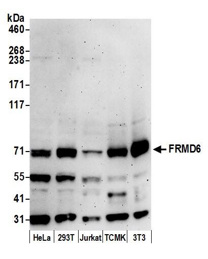 Western Blot FRMD6 Antibody