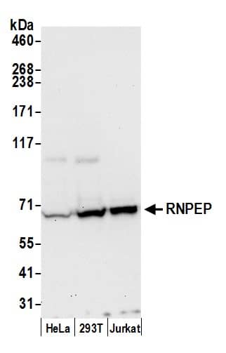 Western Blot;Aminopeptidase B/RNPEP Antibody  Whole cell lysate (50 µg) from HeLa, HEK293T, and Jurkat cells prepared using NETN lysis buffer. Antibody: Affinity purified rabbit anti-RNPEP antibody  used for WB at 0.4 mg/ml. Detection: Chemiluminescence with an exposure time of 30 seconds.