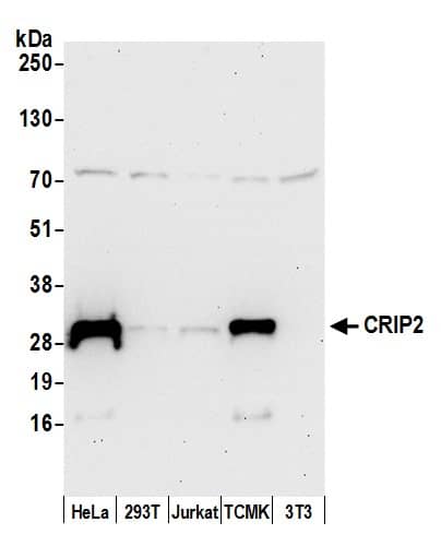 Western Blot;CRIP2 Antibody  Whole cell lysate (50 µg) from HeLa, HEK293T, Jurkat, mouse TCMK-1, and mouse NIH 3T3 cells prepared using NETN lysis buffer. Antibody: Affinity purified rabbit anti-CRIP2 antibody  used for WB at 0.1 mg/ml. Detection: Chemiluminescence with an exposure time of 30 seconds.