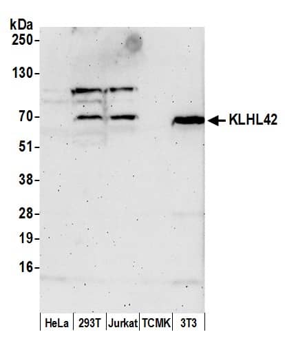 Western Blot;KLHDC5 Antibody  Whole cell lysate (50 µg) from HeLa, HEK293T, Jurkat, mouse TCMK-1, and mouse NIH 3T3 cells prepared using NETN lysis buffer. Antibody: Affinity purified rabbit anti-KLHL42 antibody  used for WB at 0.1 mg/ml. Detection: Chemiluminescence with an exposure time of 3 minutes.