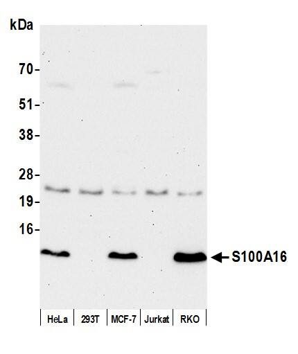 Western Blot;S100A16 Antibody  Whole cell lysate (50 µg) from HeLa, HEK293T, MCF-7, Jurkat, and RKO cells prepared using NETN lysis buffer. Antibody: Affinity purified rabbit anti-S100A16 antibody  used for WB at 0.1 mg/ml. Detection: Chemiluminescence with an exposure time of 30 seconds.