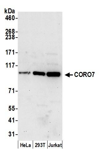 Western Blot;CORO7 Antibody  Whole cell lysate (50 µg) from HeLa, HEK293T, and Jurkat cells prepared using NETN lysis buffer. Antibody: Affinity purified rabbit anti-CORO7 antibody  used for WB at 0.1 mg/ml. Detection: Chemiluminescence with an exposure time of 30 seconds.