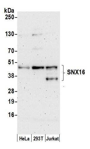 Western Blot;SNX16 Antibody  Whole cell lysate (50 µg) from HeLa, HEK293T, and Jurkat cells prepared using NETN lysis buffer. Antibody: Affinity purified rabbit anti-SNX16 antibody  used for WB at 0.1 mg/ml. Detection: Chemiluminescence with an exposure time of 3 minutes.